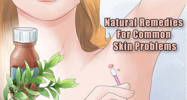 skin tags removal