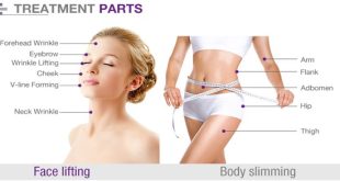 ultherapy body contouring sites