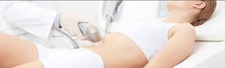هایفوتراپی شکم برای لاغری