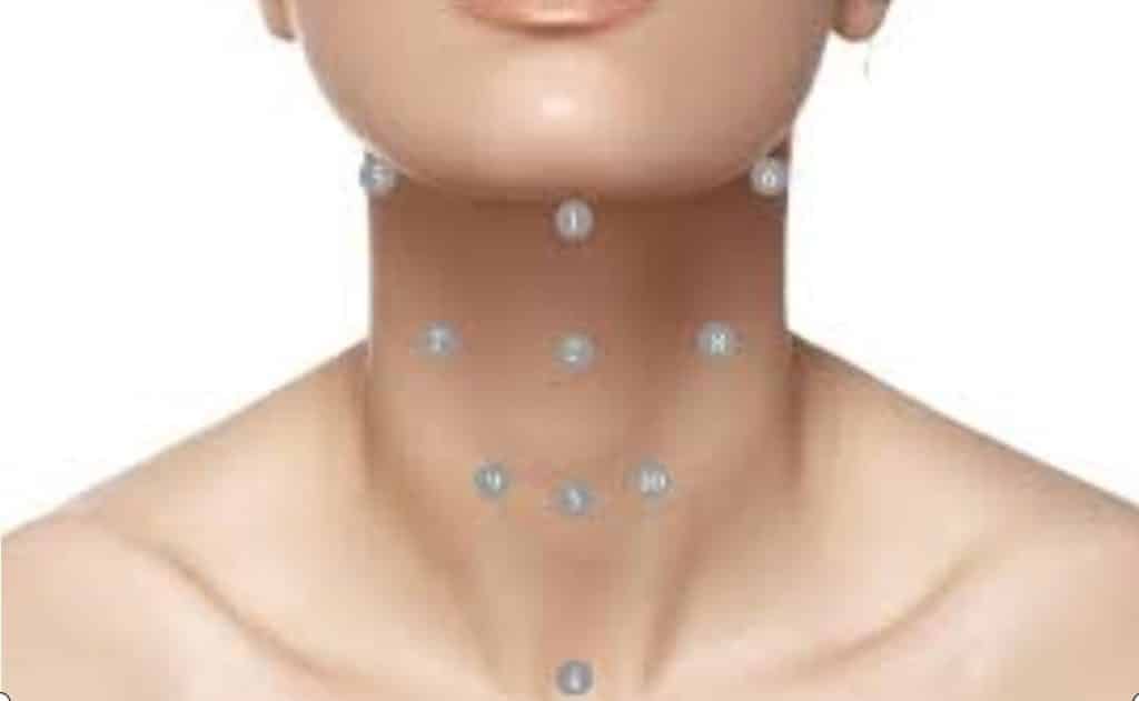 پروفایلو گردن